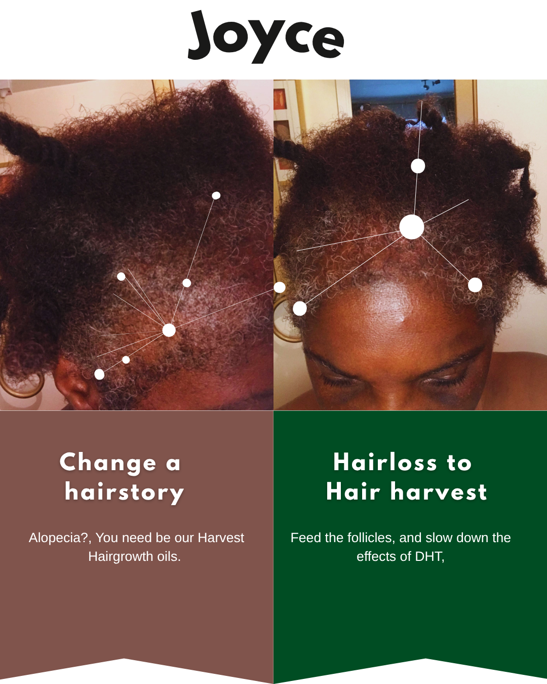 Alopecia + Thinning Hair Solutions - The Harvest Hair Growth Kit