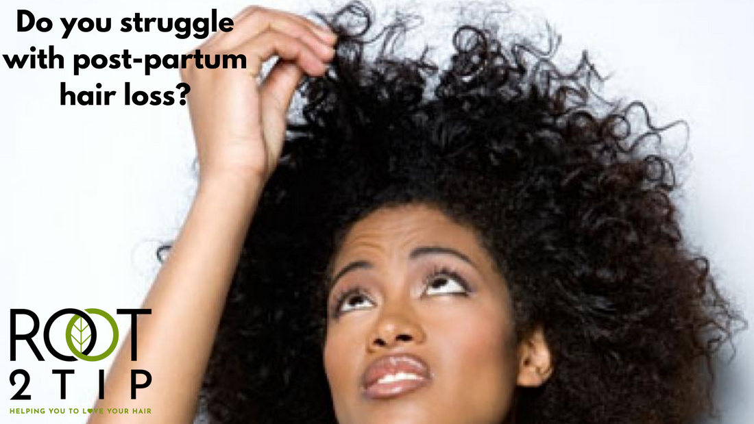 How To Handle Postpartum Hair Loss: Top 7 Tips