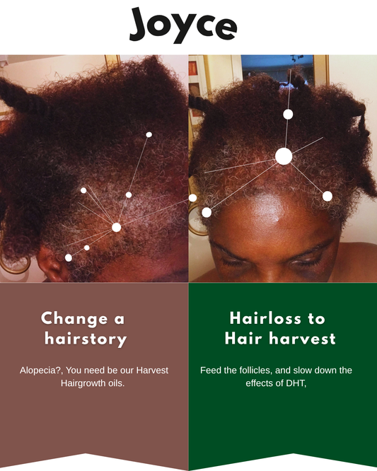 Root2Tip Harvest Hair Growth Kit — Plant-Based Alopecia & Thinning Hair Treatment